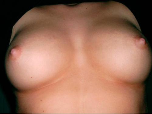 Attached Image