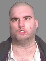 Attached Image
