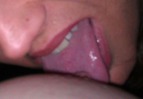 Attached Image