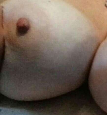 Attached Image