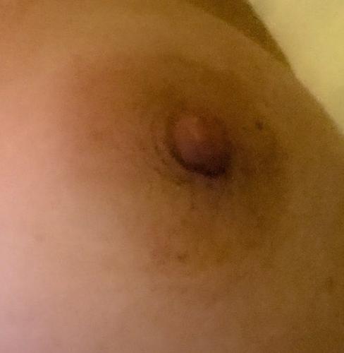 Attached Image
