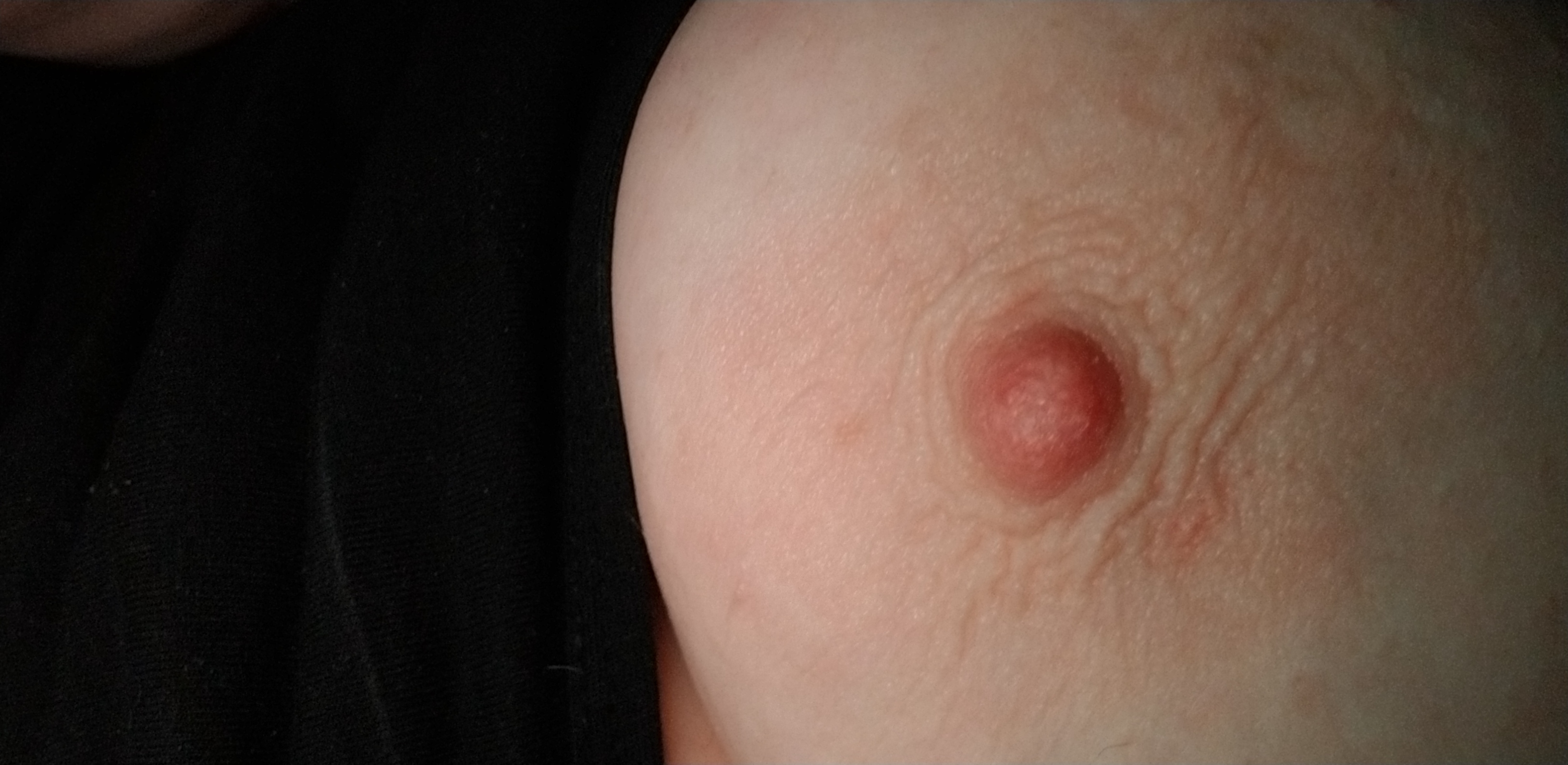 Attached Image
