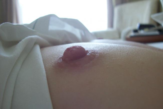 Attached Image