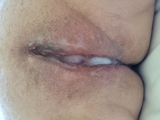 Attached Image